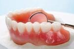 Dentist in Sydney: The Pros and Cons of Partial Denture